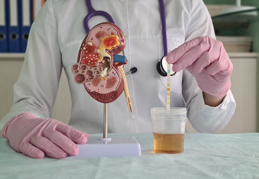 Kidney Toxicity